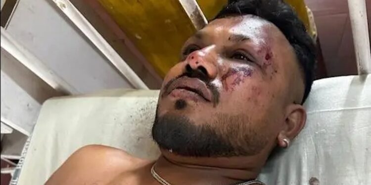 Αεροπορικό δυστύχημα στην Ινδία: Από θαύμα γλίτωσε ο μοναδικός επιζών επιβάτης της θέσης 11Α