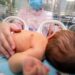 Χανιά: Στην Εντατική Νεογνών με Covid 19 βρέφος 16 ημερών