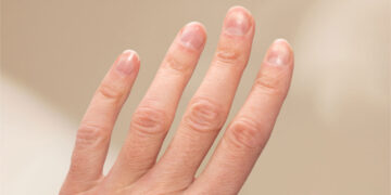 Τι πρέπει να προσέχεις για να έχεις υγιή νύχια
