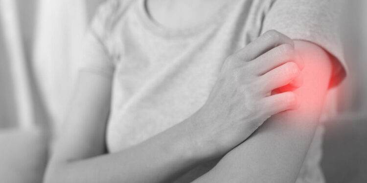 Έκζεμα κατά την εφηβεία: Τι ευθύνεται