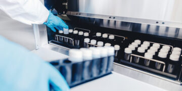 Σε 7 κλινικές στην Ελλάδα είχε δοθεί το σπέρμα του Δανού με το γονίδιο που προκαλεί καρκινογεννέσεις – Εντοπίστηκε σε 3 παιδιά μίας οικογένειας