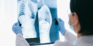 Ακτινογραφία Θώρακος: Το Γρήγορο "Παράθυρο" στην Υγεία της Καρδιάς και των Πνευμόνων