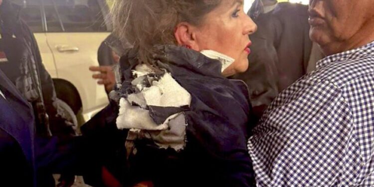 Ονδούρα: Επίθεση με αυτοσχέδιο εκρηκτικό μηχανισμό έξω από το Κογκρέσο - Τραυματίστηκε βουλευτής του Εθνικού Κόμματος 