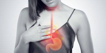 Καούρα: Ποις τροφές την προκαλούν