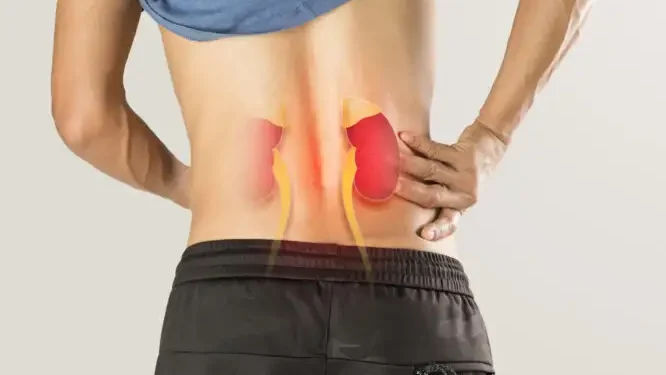 Πέτρες στα νεφρά; Σύμφωνα με νέες μελέτες δεν αρκεί να πίνετε πολύ νερό