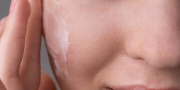 Skincare layering: με ποια σειρά πρέπει να βάζεις τα προϊόντα σου για μέγιστο αποτέλεσμα