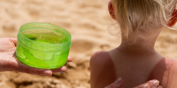 Οδηγός για σωστή περιποίηση μετά τον ήλιο