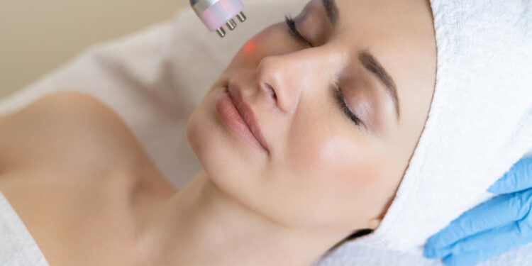 Microneedling: πότε ενδείκνυται