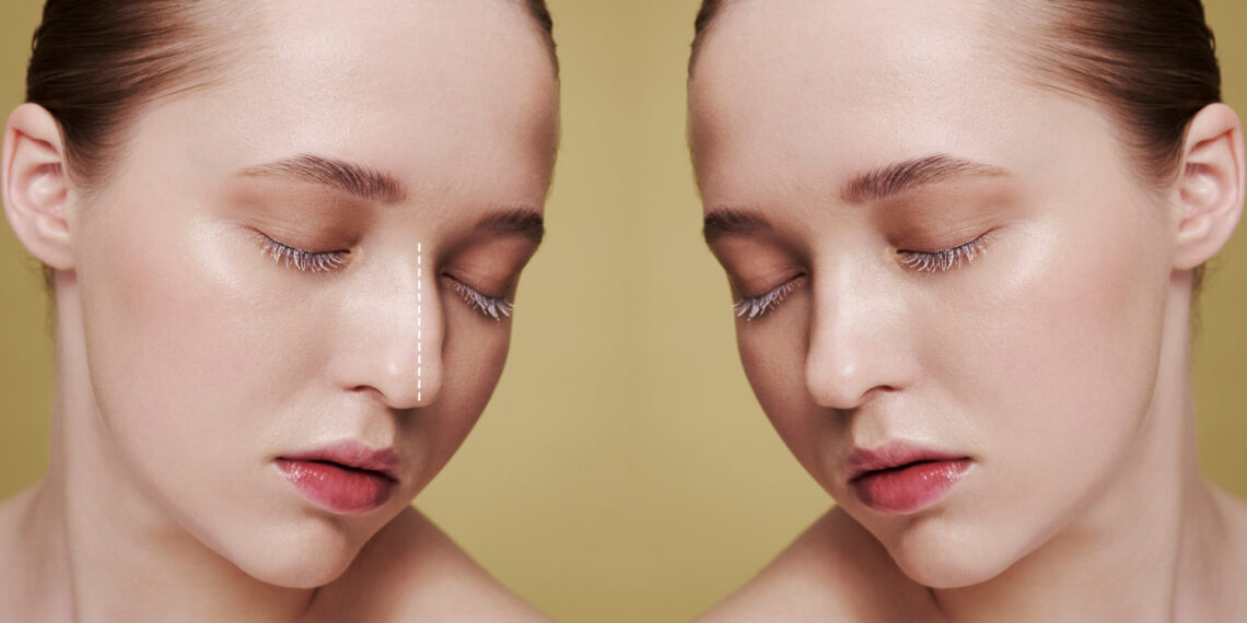 Dewy vs matte skin