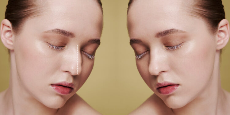 Dewy vs matte skin