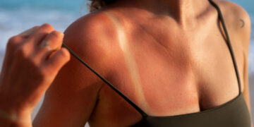 Bronzing σωστά