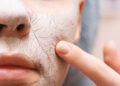 Dry skin fixes
