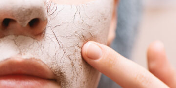 Dry skin fixes
