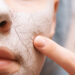Dry skin fixes
