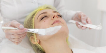 Laser ή χημικό peeling; Ποια επιλογή είναι καλύτερη;