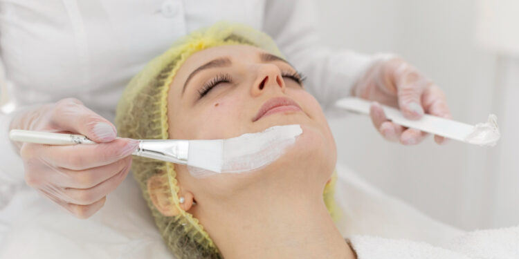 Laser ή χημικό peeling; Ποια επιλογή είναι καλύτερη;