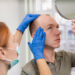 Αλωπεκία: τύποι και σύγχρονες θεραπευτικές επιλογές
