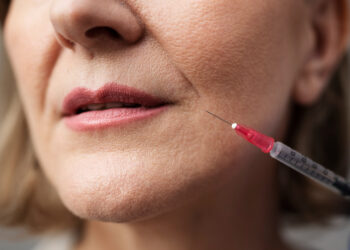 Τι πρέπει να γνωρίζετε για τα fillers και το botox από ιατρική σκοπιά