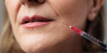 Τι πρέπει να γνωρίζετε για τα fillers και το botox από ιατρική σκοπιά