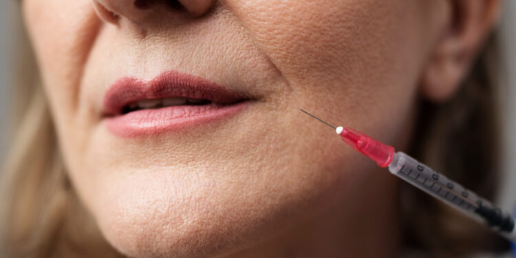 Τι πρέπει να γνωρίζετε για τα fillers και το botox από ιατρική σκοπιά