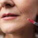 Τι πρέπει να γνωρίζετε για τα fillers και το botox από ιατρική σκοπιά