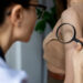 Τι είναι η κεράτωση pilaris και πώς αντιμετωπίζεται αποτελεσματικά