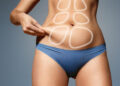 Η σχέση μεταξύ εντέρου και δέρματος (gut-skin axis)