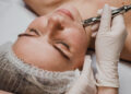 Microneedling: Πώς βοηθά το δέρμα;