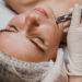 Microneedling: Πώς βοηθά το δέρμα;