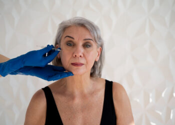 Υπάρχει σωστή ηλικία για Botox;