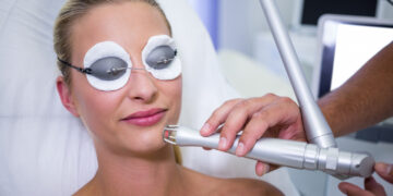 Fractional laser: Ενδείξεις και αποτελέσματα